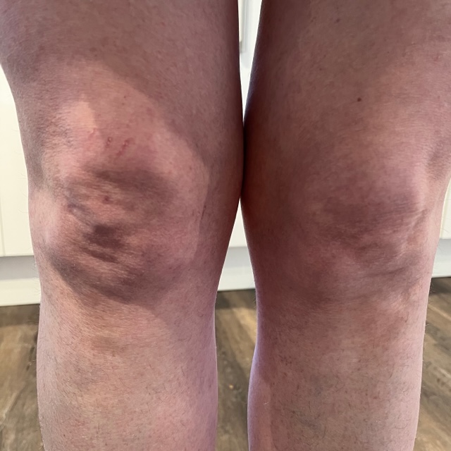 A picture of two middle-aged knees